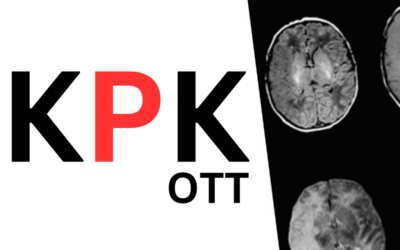 KPK OTT – Cara Ampuh Mencegah Stroke